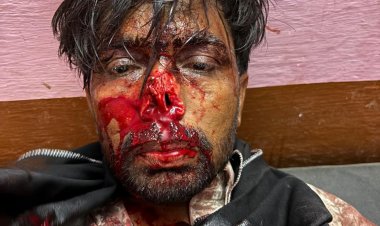 सांकड़ा क्षेत्र में युवक का नाक काट मौके से फरार हुए बदमाश